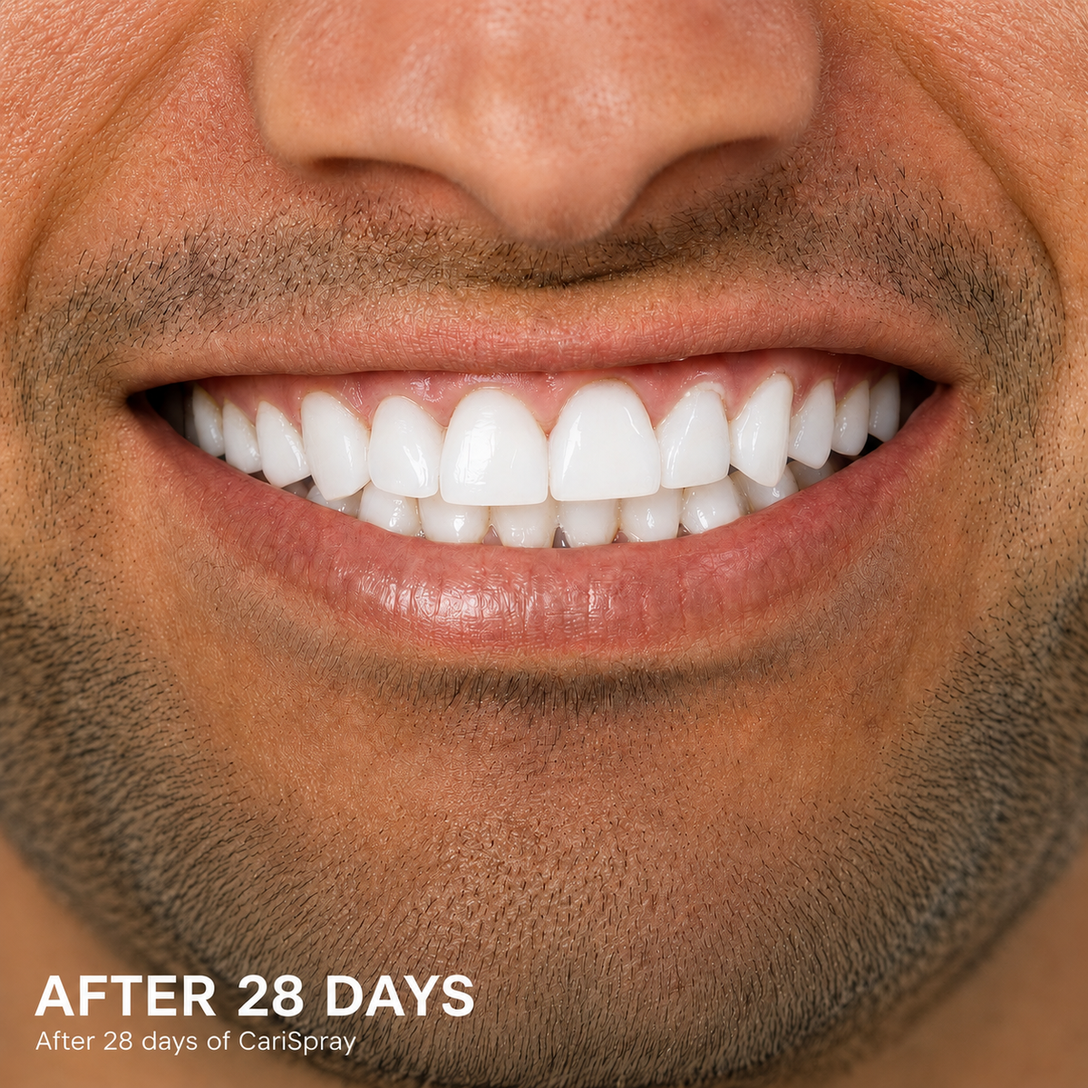 AFTER 28 DAYS